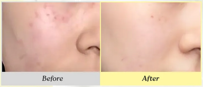 Dr. Althea - 345 Relief Cream